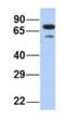 Membrane Palmitoylated Protein 5 antibody, NBP1-54724, Novus Biologicals, Western Blot image 