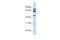 Protein Phosphatase 4 Regulatory Subunit 2 antibody, GTX46965, GeneTex, Western Blot image 