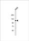 Epithelial Cell Transforming 2 Like antibody, PA5-48246, Invitrogen Antibodies, Western Blot image 