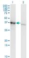 Poly(RC) Binding Protein 1 antibody, H00005093-M01, Novus Biologicals, Western Blot image 