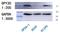 Dpy-30 Histone Methyltransferase Complex Regulatory Subunit antibody, NBP1-91848, Novus Biologicals, Western Blot image 