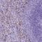 Leucine Zipper Like Transcription Regulator 1 antibody, PA5-64454, Invitrogen Antibodies, Immunohistochemistry paraffin image 