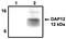 TYRO Protein Tyrosine Kinase Binding Protein antibody, MBS395757, MyBioSource, Western Blot image 