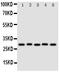 Stanniocalcin 1 antibody, PA1997, Boster Biological Technology, Western Blot image 