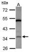 Leucine Rich Alpha-2-Glycoprotein 1 antibody, PA5-31046, Invitrogen Antibodies, Western Blot image 