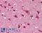 Dynamin 1 antibody, LS-B1827, Lifespan Biosciences, Immunohistochemistry paraffin image 