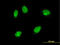 Mitogen-Activated Protein Kinase 6 antibody, LS-C197995, Lifespan Biosciences, Immunofluorescence image 