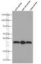 Survival Of Motor Neuron 2, Centromeric antibody, 60154-1-Ig, Proteintech Group, Western Blot image 