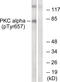 Protein Kinase C Alpha antibody, 79-806, ProSci, Western Blot image 