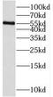 Phosphoprotein Membrane Anchor With Glycosphingolipid Microdomains 1 antibody, FNab06112, FineTest, Western Blot image 