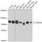 DEAD-Box Helicase 3 X-Linked antibody, 13-428, ProSci, Western Blot image 