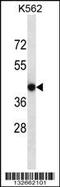 Calcium Voltage-Gated Channel Auxiliary Subunit Gamma 4 antibody, 56-705, ProSci, Western Blot image 