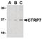 C1q And TNF Related 7 antibody, PA5-20157, Invitrogen Antibodies, Western Blot image 