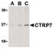 C1q And TNF Related 7 antibody, PA5-20157, Invitrogen Antibodies, Western Blot image 