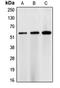 Checkpoint Kinase 1 antibody, orb213732, Biorbyt, Western Blot image 