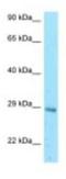 Eukaryotic Translation Initiation Factor 3 Subunit K antibody, NBP1-98396, Novus Biologicals, Western Blot image 