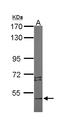 Serine/Threonine Kinase 4 antibody, LS-C186061, Lifespan Biosciences, Western Blot image 