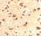 RUN And SH3 Domain Containing 2 antibody, NBP2-81786, Novus Biologicals, Immunohistochemistry paraffin image 