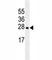 Eukaryotic Translation Initiation Factor 4E Family Member 2 antibody, F53545-0.1ML, NSJ Bioreagents, Western Blot image 