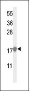 p21 antibody, LS-C163310, Lifespan Biosciences, Western Blot image 