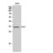 Caudal Type Homeobox 2 antibody, LS-C382639, Lifespan Biosciences, Western Blot image 