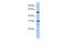 Inosine Monophosphate Dehydrogenase 1 antibody, PA5-44146, Invitrogen Antibodies, Western Blot image 