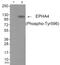 EPH Receptor A4 antibody, GTX55376, GeneTex, Western Blot image 