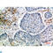 Cytokine Inducible SH2 Containing Protein antibody, LS-C813820, Lifespan Biosciences, Immunohistochemistry paraffin image 