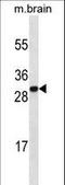 High Mobility Group Box 1 antibody, LS-C164932, Lifespan Biosciences, Western Blot image 