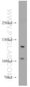 Transforming Growth Factor Beta Receptor 3 antibody, 20000-1-AP, Proteintech Group, Western Blot image 