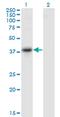 Serpin Family B Member 10 antibody, MA5-24419, Invitrogen Antibodies, Western Blot image 