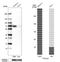 Phosphatidylinositol Binding Clathrin Assembly Protein antibody, HPA019053, Atlas Antibodies, Western Blot image 