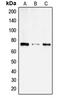 Solute Carrier Family 6 Member 14 antibody, LS-C353317, Lifespan Biosciences, Western Blot image 