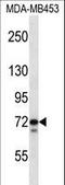 Thymopoietin antibody, LS-C162037, Lifespan Biosciences, Western Blot image 