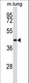 Protein Kinase X-Linked antibody, LS-C164558, Lifespan Biosciences, Western Blot image 