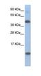 Ligand Dependent Nuclear Receptor Corepressor antibody, orb324711, Biorbyt, Western Blot image 