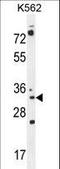 Pyrroline-5-Carboxylate Reductase 2 antibody, LS-C162338, Lifespan Biosciences, Western Blot image 