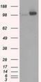 Hexokinase 2 antibody, NBP2-02272, Novus Biologicals, Western Blot image 