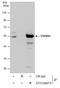 Nicotinamide Phosphoribosyltransferase antibody, GTX128973, GeneTex, Immunoprecipitation image 