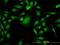 PDZ Binding Kinase antibody, H00055872-M06, Novus Biologicals, Immunocytochemistry image 