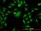 PBK/TOPK antibody, H00055872-M06, Novus Biologicals, Immunocytochemistry image 