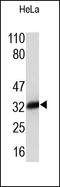 Annexin A4 antibody, 251828, Abbiotec, Western Blot image 