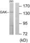 Cyclin G Associated Kinase antibody, LS-B9887, Lifespan Biosciences, Western Blot image 