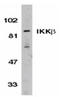 Inhibitor Of Nuclear Factor Kappa B Kinase Subunit Beta antibody, ADI-KAP-TF118-E, Enzo Life Sciences, Western Blot image 