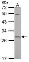 Synaptosomal-associated protein 23 antibody, PA5-31028, Invitrogen Antibodies, Western Blot image 