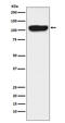 Itchy E3 Ubiquitin Protein Ligase antibody, M00195, Boster Biological Technology, Western Blot image 