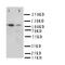 Integrin Subunit Alpha 3 antibody, LS-C312776, Lifespan Biosciences, Western Blot image 
