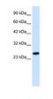 Regulator Of G Protein Signaling 13 antibody, orb329758, Biorbyt, Western Blot image 