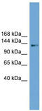 Coiled-Coil Domain Containing 146 antibody, TA344755, Origene, Western Blot image 