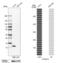 S100 Calcium Binding Protein A16 antibody, PA5-61104, Invitrogen Antibodies, Western Blot image 